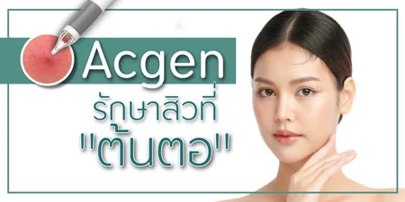 Acgen แอกเจน รักษา สิว