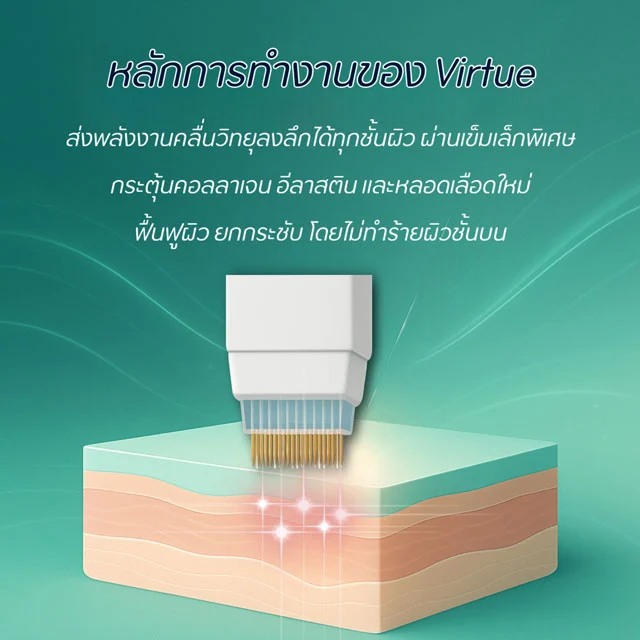 หลักการทำงาน microneedling Virtue RF